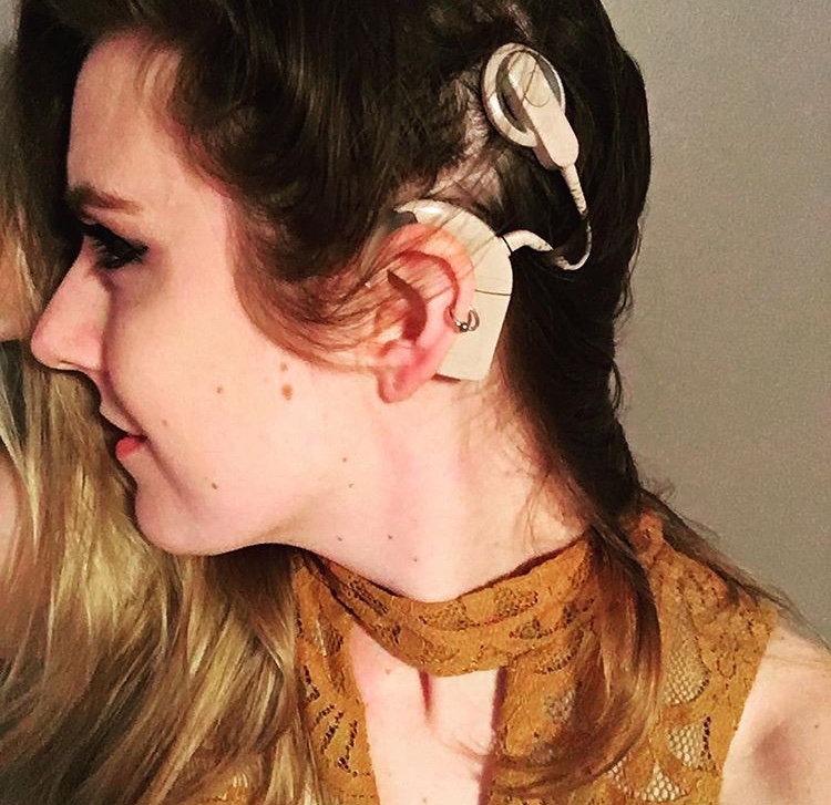 What it’s Like to be a Twenty-Something with&nbsp;CIs